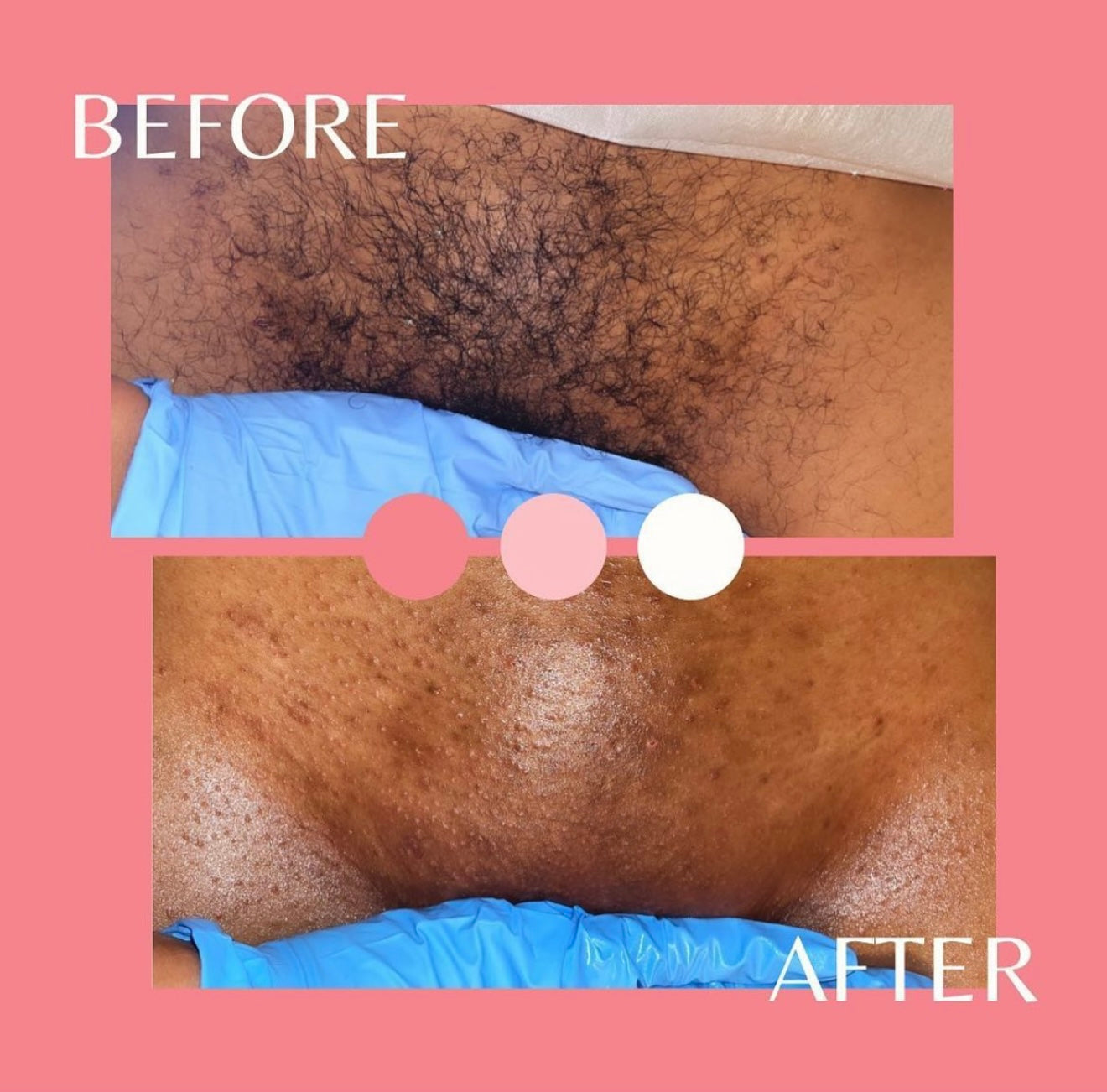 Advanced Full Body Wax Masterclass + Intimate Skincare Treatment (Deposit)