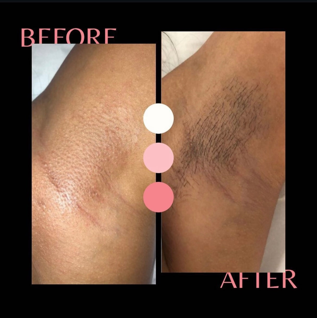 Advanced Full Body Wax Masterclass + Intimate Skincare Treatment (Deposit)